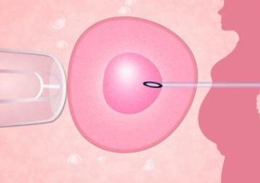 安庆地区有哪些私立的机构可以做试管技术？二特需泡会腹水么？