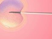 永州零陵区哪里可以做试管婴儿呢？