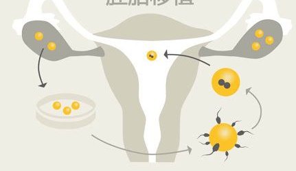 三代试管婴儿有多少人成功了-三代试管婴儿已经多少年了