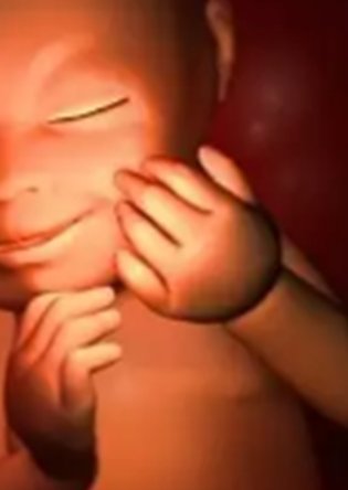 梗阻性无精症能做试管婴儿吗？可采用以下三种方法！